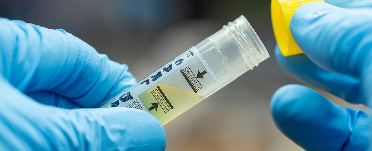 Dopinganalytik Hände halten ein Probenröhren mit Flüssigkeit in der Hand